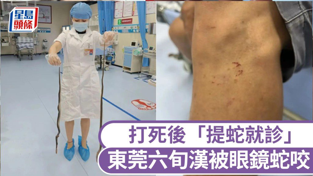 驚險！東莞六旬翁捕魚遭眼鏡蛇咬，怒打死蛇後淡定求醫