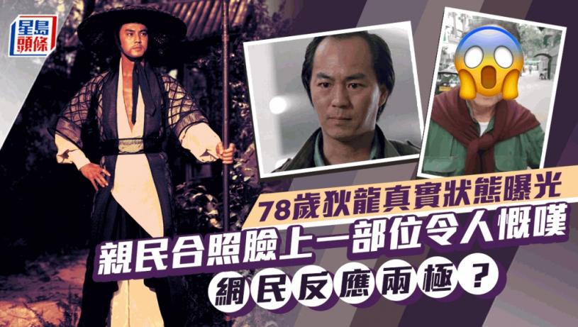 78歲狄龍真實狀態曝光!親民與Fans合照臉上一部位令人慨嘆 網民反應兩極?
