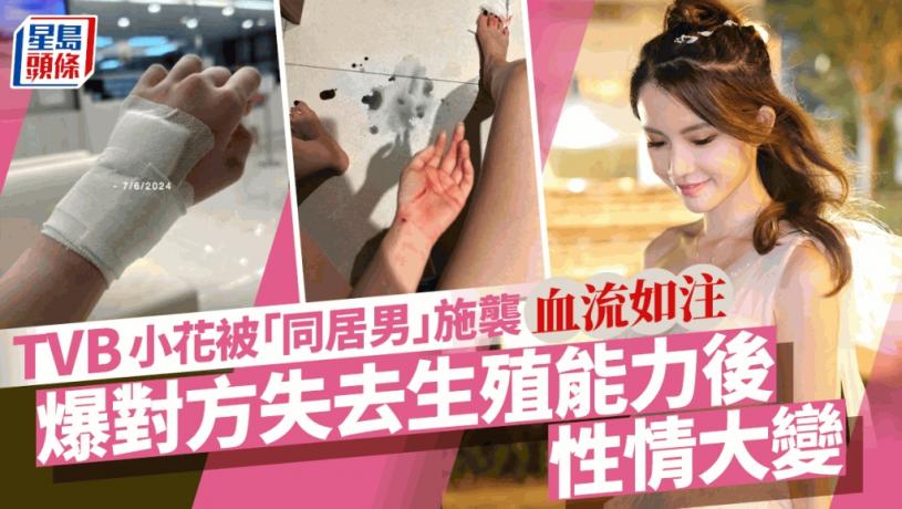 TVB小花被「同居男」施襲血流如注 爆對方失去生殖能力後性情大變